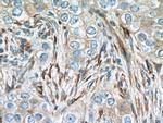 IFIT1 Antibody in Immunohistochemistry (Paraffin) (IHC (P))