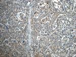 IFIT1 Antibody in Immunohistochemistry (Paraffin) (IHC (P))