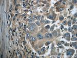 IFIT1 Antibody in Immunohistochemistry (Paraffin) (IHC (P))