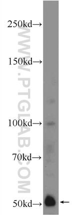 IFIT1 Antibody in Western Blot (WB)