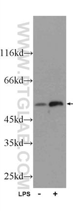 IFIT1 Antibody in Western Blot (WB)