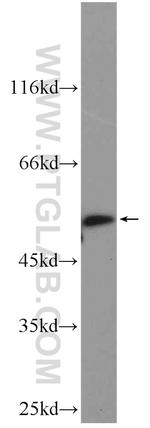 IFIT1 Antibody in Western Blot (WB)