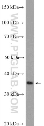 RSPH9 Antibody in Western Blot (WB)