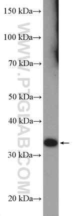 RSPH9 Antibody in Western Blot (WB)