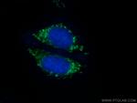 IDH2 Antibody in Immunocytochemistry (ICC/IF)