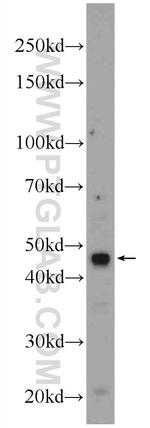 KCNN4 Antibody in Western Blot (WB)