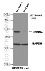 KCNN4 Antibody in Western Blot (WB)