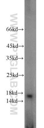A2LD1 Antibody in Western Blot (WB)
