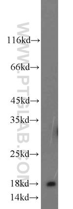 A2LD1 Antibody in Western Blot (WB)