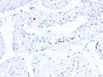 CSTF2T (Transcription Factor) Antibody in Immunohistochemistry (Paraffin) (IHC (P))
