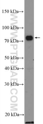 TICAM1 Antibody in Western Blot (WB)