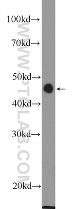 MTERFD1 Antibody in Western Blot (WB)