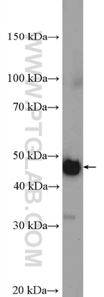 MTERFD1 Antibody in Western Blot (WB)