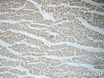 UPF3B Antibody in Immunohistochemistry (Paraffin) (IHC (P))