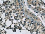 UPF3B Antibody in Immunohistochemistry (Paraffin) (IHC (P))