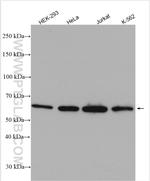 UPF3B Antibody in Western Blot (WB)