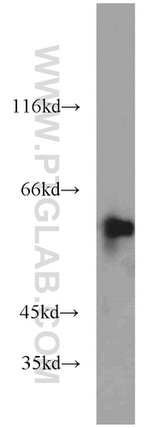 UPF3B Antibody in Western Blot (WB)