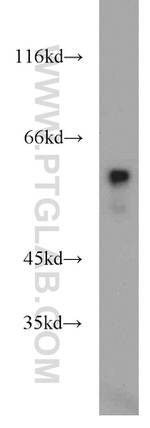 UPF3B Antibody in Western Blot (WB)