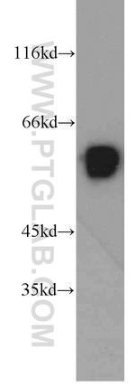 UPF3B Antibody in Western Blot (WB)