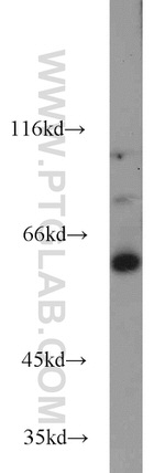 UPF3B Antibody in Western Blot (WB)