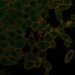 UBR2/E3 ubiquitin-protein ligase UBR2 (Transcription Factor) Antibody in Immunocytochemistry (ICC/IF)