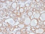UBR2/E3 ubiquitin-protein ligase UBR2 (Transcription Factor) Antibody in Immunohistochemistry (Paraffin) (IHC (P))