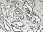 LGALS3BP Antibody in Immunohistochemistry (Paraffin) (IHC (P))