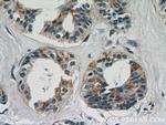 LGALS3BP Antibody in Immunohistochemistry (Paraffin) (IHC (P))