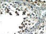 BCMO1 Antibody in Immunohistochemistry (Paraffin) (IHC (P))