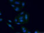 STAG3 Antibody in Immunocytochemistry (ICC/IF)