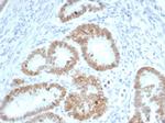 SATB2 (Colorectal Carcinoma Marker) Monoclonal Antibody (SATB2/7110)
