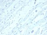 SATB2 (Colorectal Carcinoma Marker) Monoclonal Antibody (SATB2/7111)