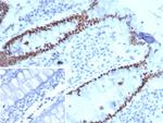 SATB2 (Colorectal Carcinoma Marker) Monoclonal Antibody (SATB2/7112)
