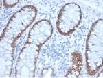 SATB2 (Colorectal Carcinoma Marker) Monoclonal Antibody (rSATB2/6929)