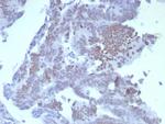 SATB2 (Colorectal Carcinoma Marker) Recombinant Rabbit Monoclonal Antibody (SATB2/8264R)