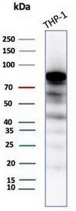 SATB2 (Colorectal Carcinoma Marker) Antibody in Western Blot (WB)