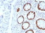SATB2 (Colorectal Carcinoma Marker) Recombinant Rabbit Monoclonal Antibody (SATB2/8877R)