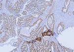 SATB2 (Colorectal Carcinoma Marker) Recombinant Rabbit Monoclonal Antibody (SATB2/9432R)