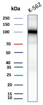 SATB2 (Colorectal Carcinoma Marker) Antibody in Western Blot (WB)