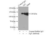 Eg5 Antibody in Immunoprecipitation (IP)