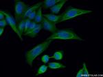 TOPBP1 Antibody in Immunocytochemistry (ICC/IF)