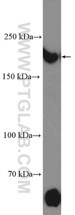 TOPBP1 Antibody in Western Blot (WB)