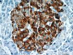 Chromogranin A Antibody in Immunohistochemistry (Paraffin) (IHC (P))