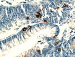 Chromogranin A Antibody in Immunohistochemistry (Paraffin) (IHC (P))