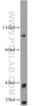 TMTC1 Antibody in Western Blot (WB)