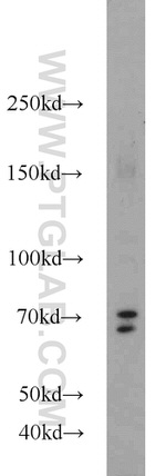 TMTC1 Antibody in Western Blot (WB)