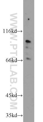 TMTC1 Antibody in Western Blot (WB)