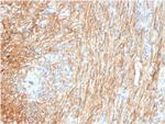 Fibronectin Monoclonal Antibody (FN1/3036)