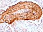 Fibronectin Monoclonal Antibody (FN1/3045)