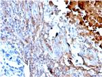 Fibronectin Monoclonal Antibody (FN1, 3568)